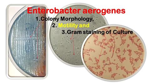 Enterobacter Aerogenes Morphology