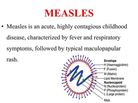 Measles, mumps, rubella | PPT