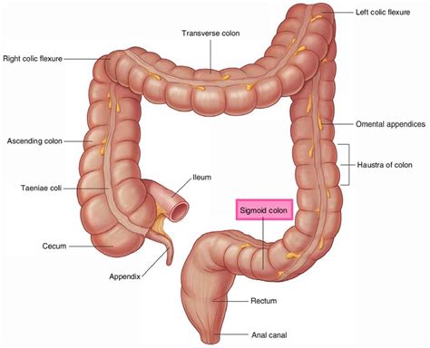 Sigmoid colon anatomy, location, function, polyps, diverticulosis & cancer