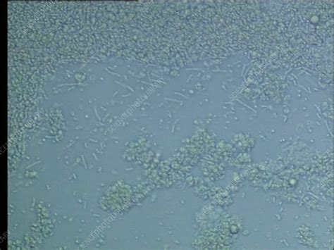 Lactobacillus bulgaricus bacteria, microscopy - Stock Video Clip - K009 ...