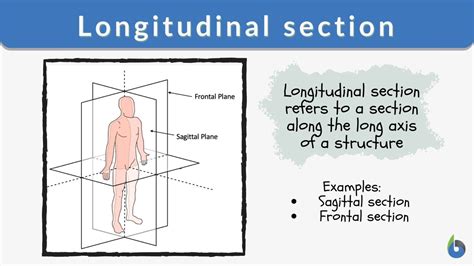 Longitudinal section - Definition and Examples - Biology Online Dictionary