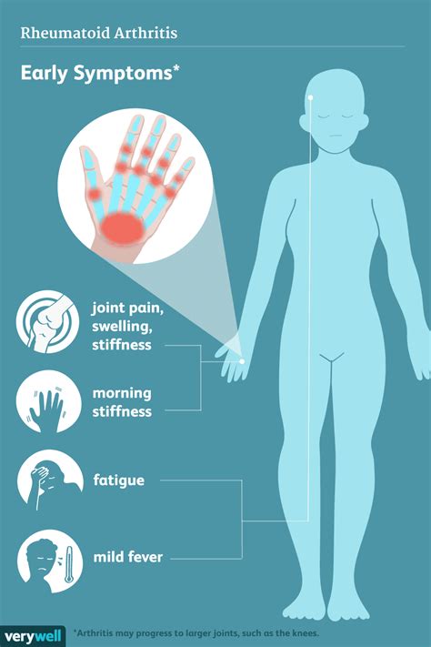 Rheumatoid Arthritis: Signs, Symptoms, and Complications