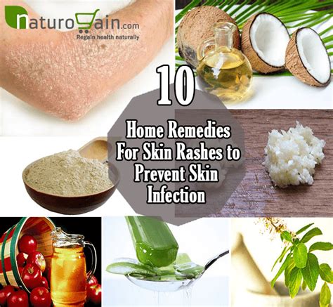 10 Simple and Best Home Remedies for Skin Rashes