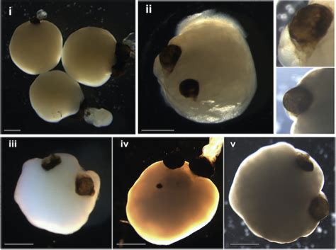 Mini brains grown in the lab sprout primitive “eyes”