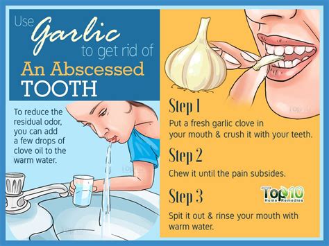 Home Remedies for an Abscessed Tooth | Top 10 Home Remedies