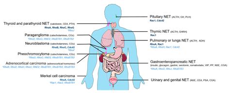 Main types of neuroendocrine tumors (NET). Mutated Rho GTPases (light ...