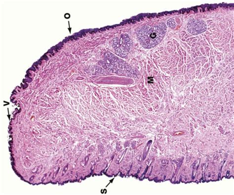 Vermilion Border Of Lip Histology | Sitelip.org