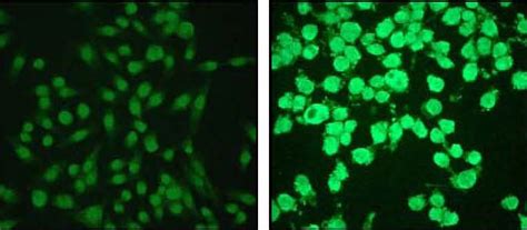 Recombinant Anti-Cleaved Caspase-3 antibody [E83-77] KO Tested (ab32042 ...