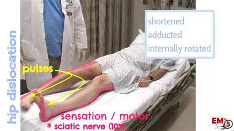 Video: Hip dislocation assessment and treatment