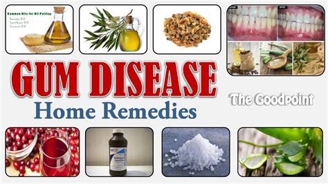 Home Remedies for Gum Disease | TheGoodPoint - The Good Point