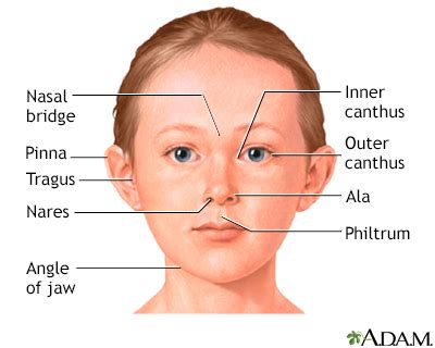 HIE Multimedia - Low nasal bridge