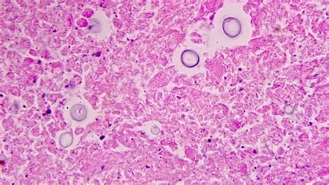 Cryptococcus Neoformans Morphology