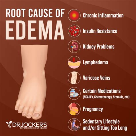 Edema: Symptoms, Causes, and Natural Support Strategies