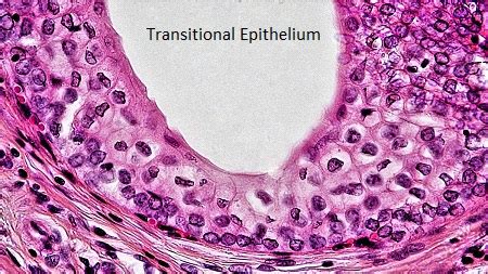 Transitional Epithelium | Function, Location & Characteristics - Lesson ...