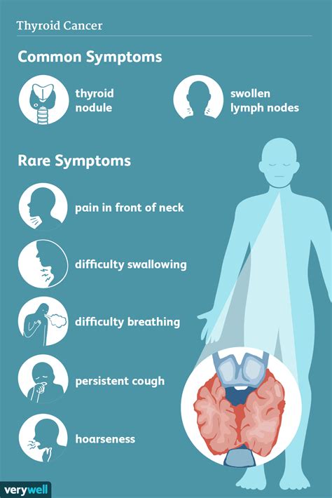 thyroid nodule symptoms - Wise Impressed