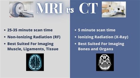 CT Scan vs MRI (What’s The Difference?) | by MRIPETCTSOURCE | Medium