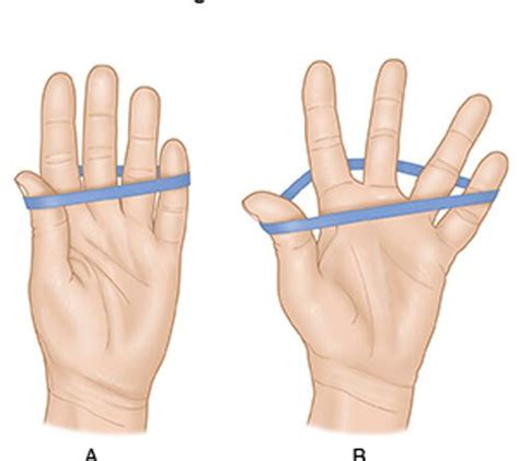 finger exercises for guitar Archives - SAMARPAN PHYSIOTHERAPY CLINIC ...