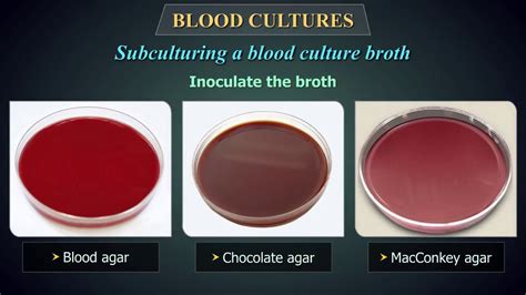 Blood cultures - YouTube