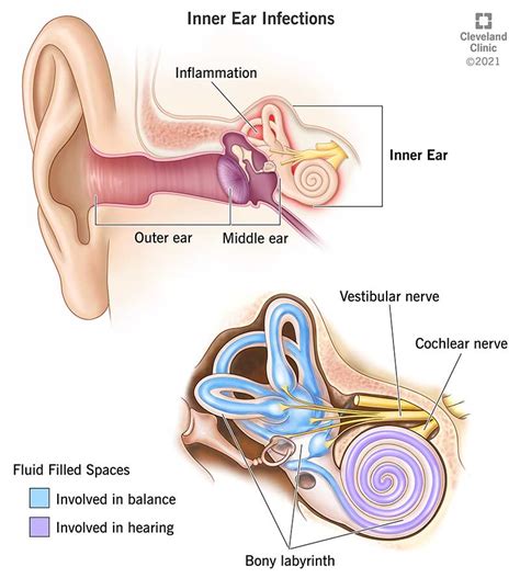 Inner Ear Infection: Symptoms, Signs & Causes