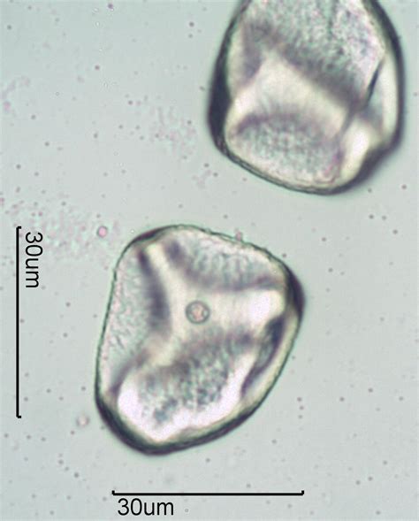 Grass (Family Poaceae) Pollen Under the Microscope