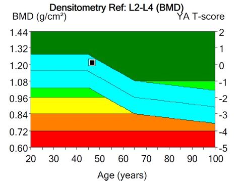 Bone density results - St Vincent's Clinic Densitometry