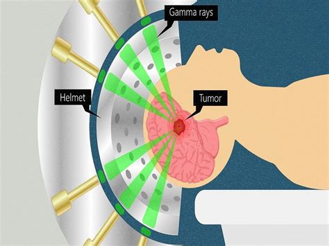 Gamma Rays Examples in Real Life – StudiousGuy