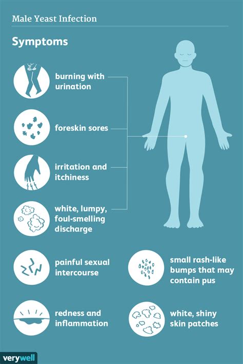 Male Yeast Infection Causes and Symptoms