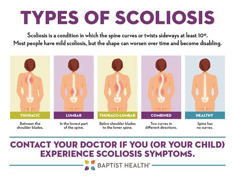 Scoliosis Types