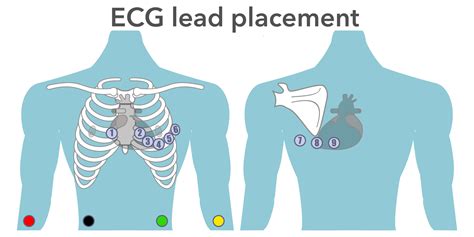 Posterior 12 Lead Ekg Placement Diagram