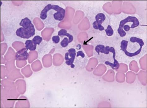 Anaplasma phagocytophilum infection in dogs: 34 cases (2000–2007) in ...