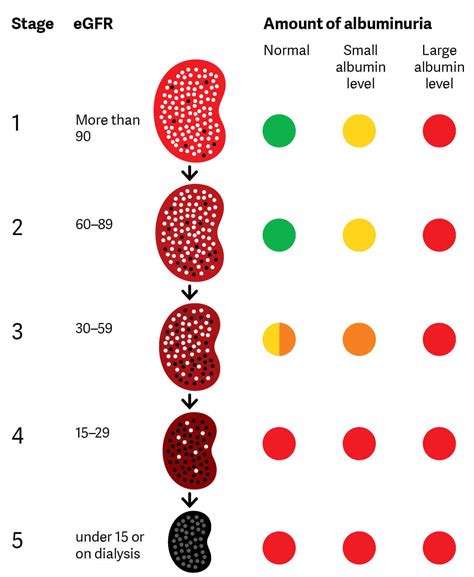 Stages Of Kidney Disease Chart