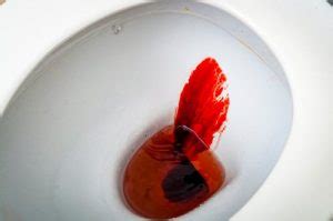 What Does Blood in Stool Look Like? Home Remedies for Rectal Bleeding