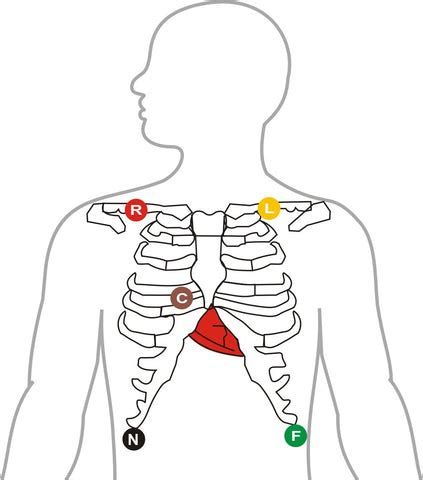 Lead ECG Cable/Electrode Three(3),Five(5),Ten(10)