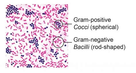 Observing Bacteria Under the Microscope - Gram Stain Steps - Rs' Science