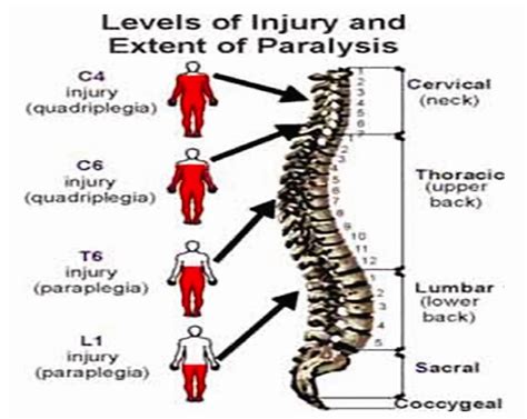 Quotes about Spinal cord injury (18 quotes)