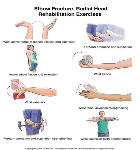 Elbow Fracture, Radial Head Rehabilitation Exercises [39] | Download ...