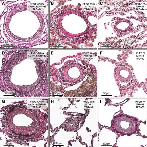 Pulmonary Artery Histology