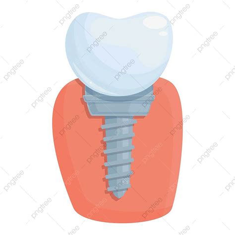 Gambar Prosedur Vektor Kartun Ikon Implan Gigi, Dental, Geraham ...