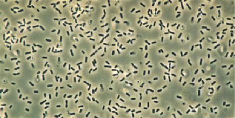 Bacillus Subtilis - The Definitive Guide | Biology Dictionary