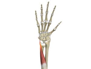 Extensor Carpi Ulnaris (ECU) Tendonitis Sandton | ECU Tendon ...