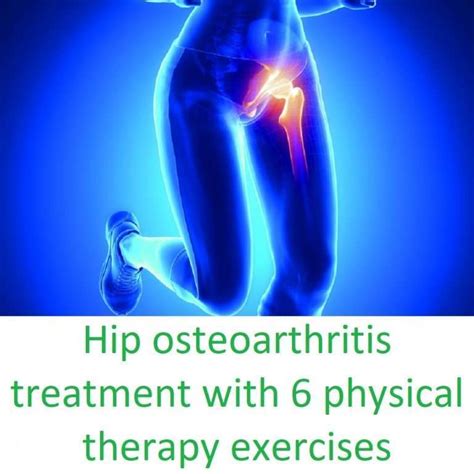 Hip osteoarthritis treatment with 6 physical therapy exercises