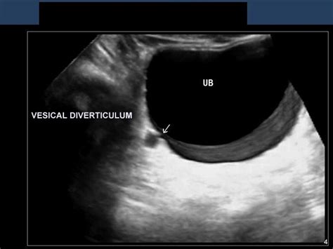 Doctors Gates: 3- D ultrasound image WOW