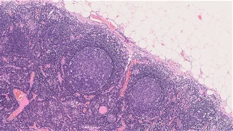 Lymph Node – Normal Histology – NUS Pathweb :: NUS Pathweb