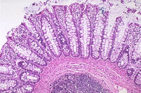 Normal Histology