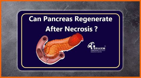 Pancreatic Necrosis | Pancreatic Necrosis Treatment | Pancreatic ...