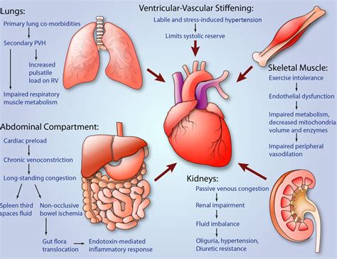 Heart Failure With Preserved Ejection Fraction | Circulation Research