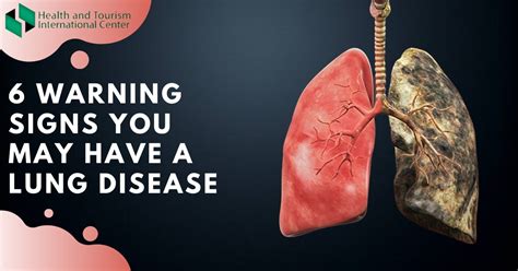 6 symptoms indicating lung problems - HTI CENTERS | Medical Tourism Center