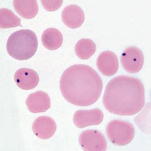 Anaplasma marginale infection in a cow | eClinpath