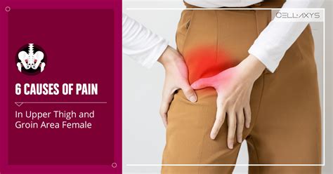 Intense Groin Pain Female Discount | aria-database.com