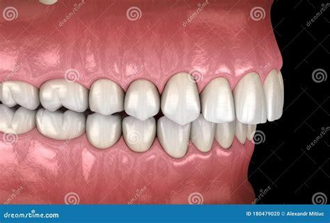 Occlusion Dental Care Logo, Modern Style Dentistry Office With Negative ...